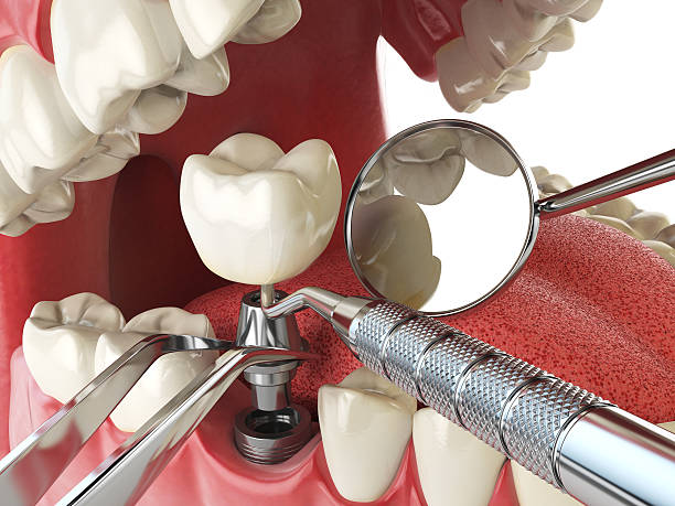 Best Cracked Tooth Emergency Dentist  in Ramtown, NJ