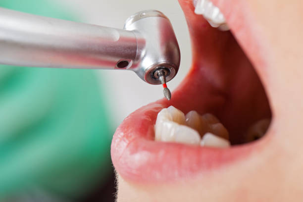 Best Root Canal Emergency Dentist  in Ramtown, NJ